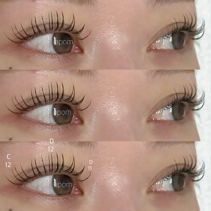 apom 森分の掲載