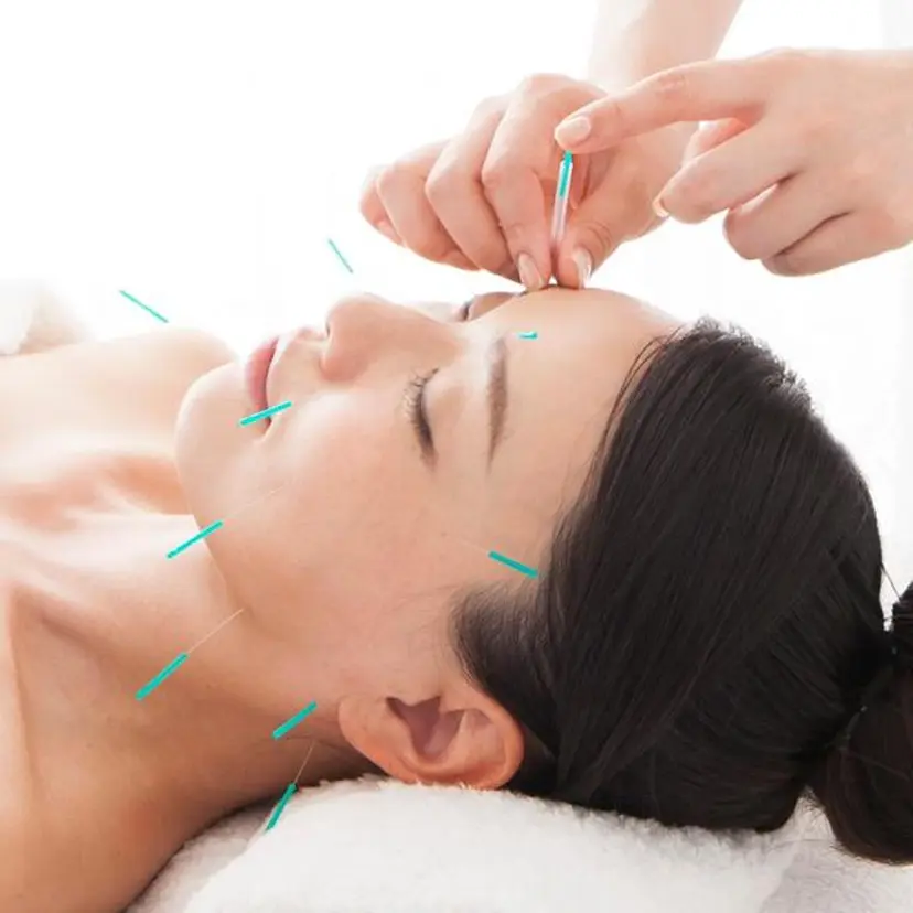 小顔矯正・美容鍼 美鍼堂の掲載