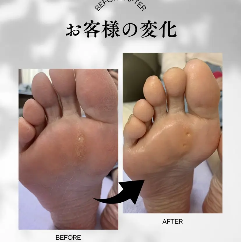 足トラブル専門 ニコルル金沢の掲載