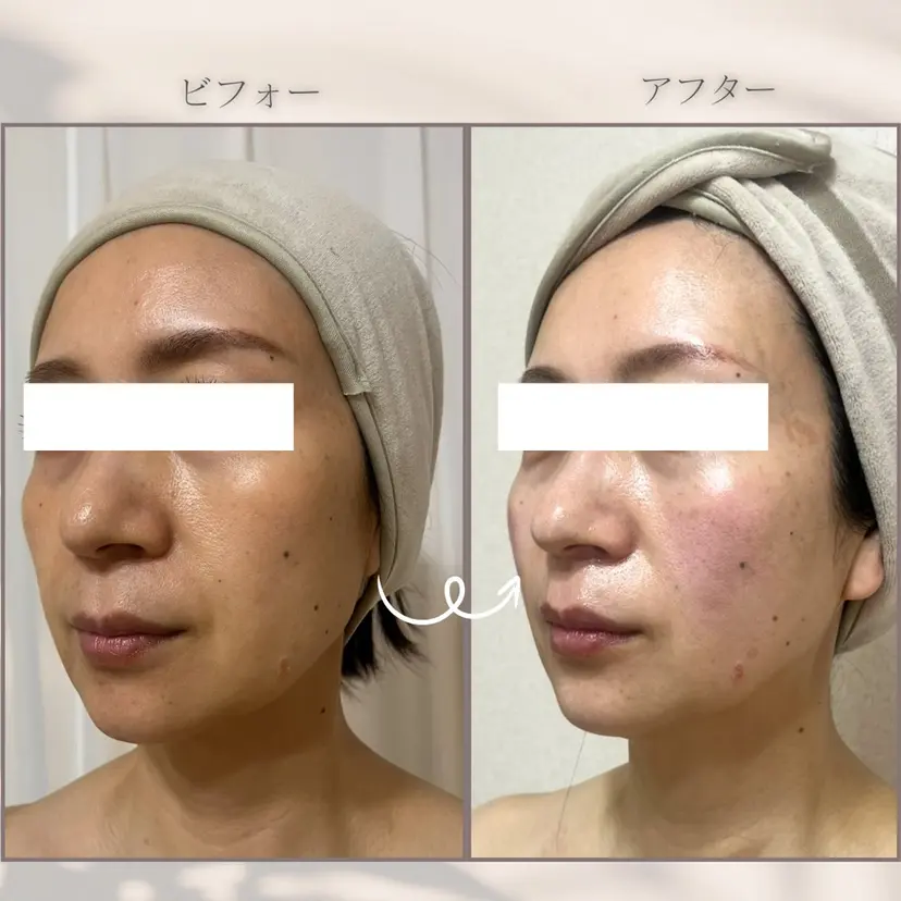 肌育WISHpro 専門サロンBloomの掲載