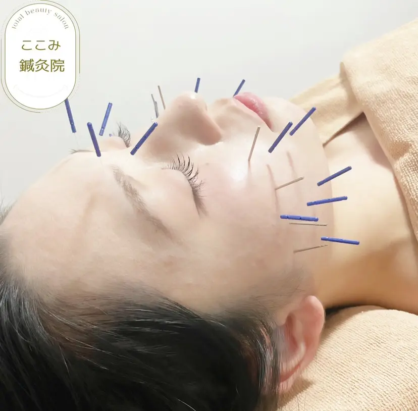 美容鍼/鍼灸 ここみ鍼灸院の掲載