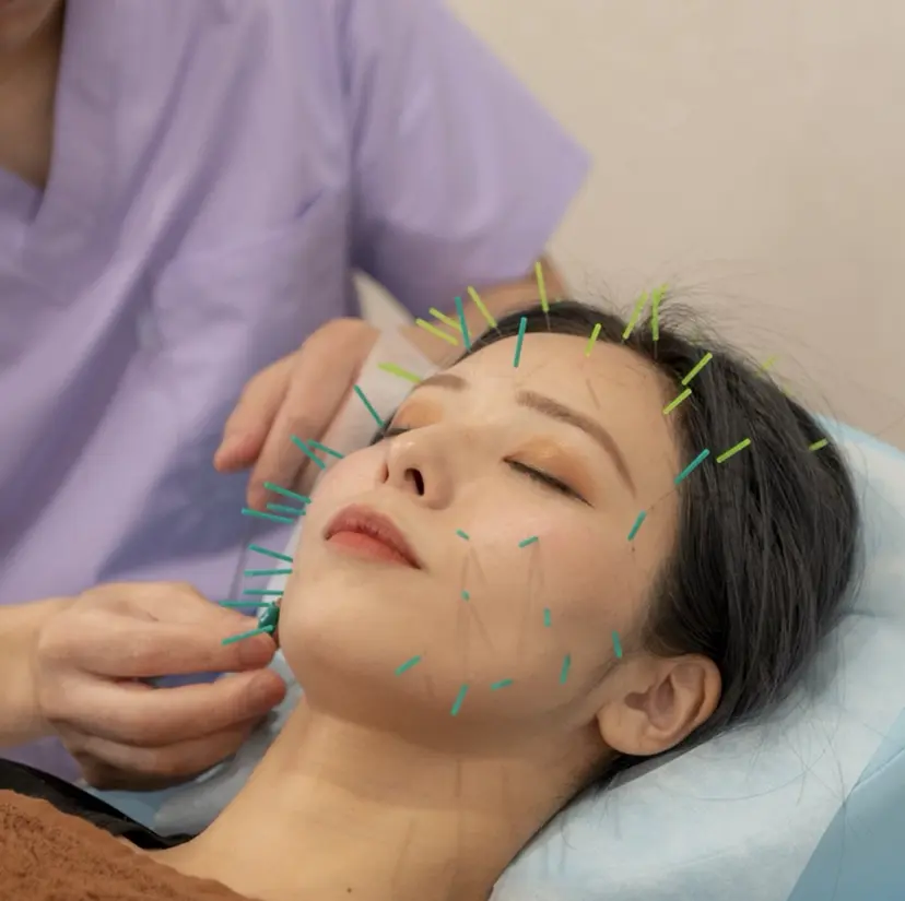 けい整骨院 鍼灸院の掲載