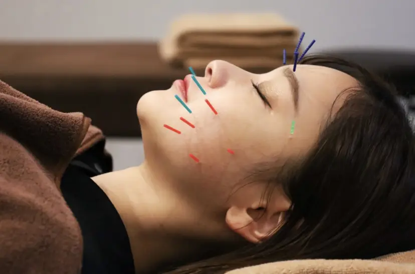 小林整骨院本町 美容鍼roomの掲載