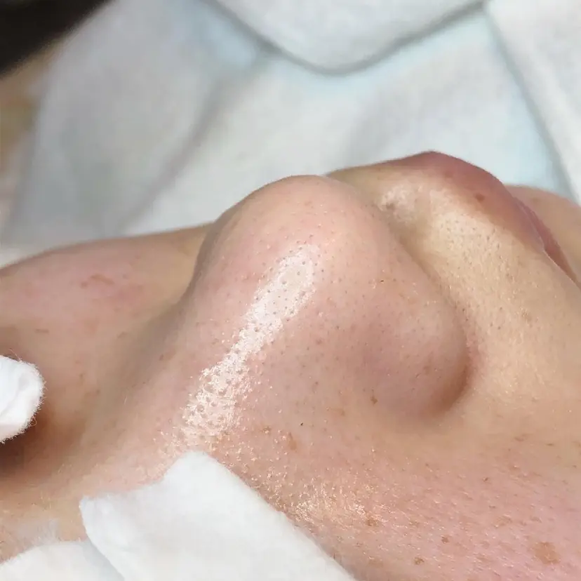 yon gypsophiraの掲載