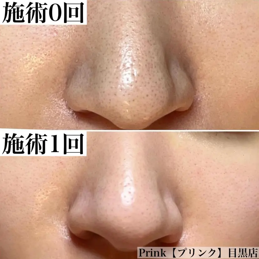 新井 ゆかの掲載