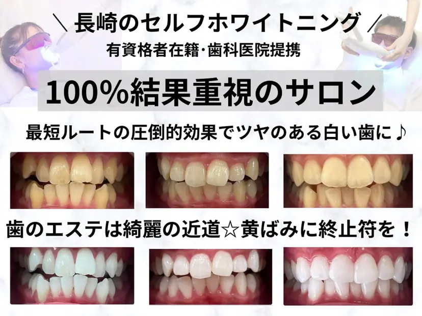 ホワイトニング ショップ長崎時津店の掲載
