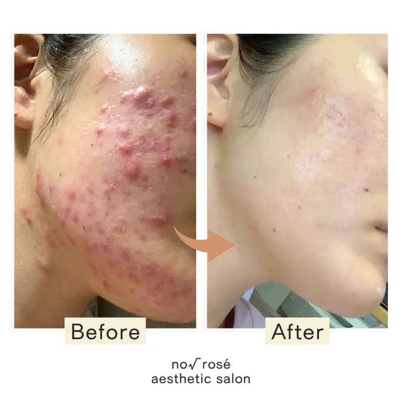 ノールート ロゼの掲載