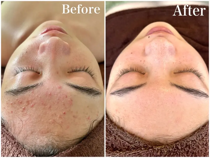 アグンダイ 香奈子の掲載