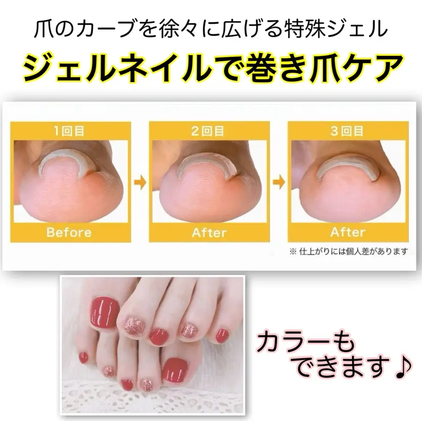 爪の専門店 by.micoの掲載