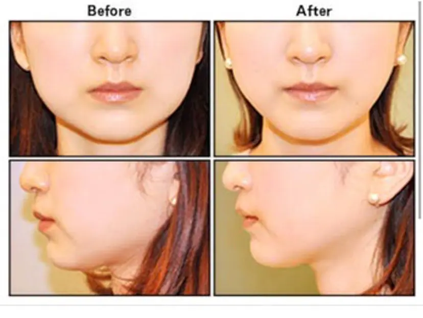 小顔専門店 Embelliの掲載