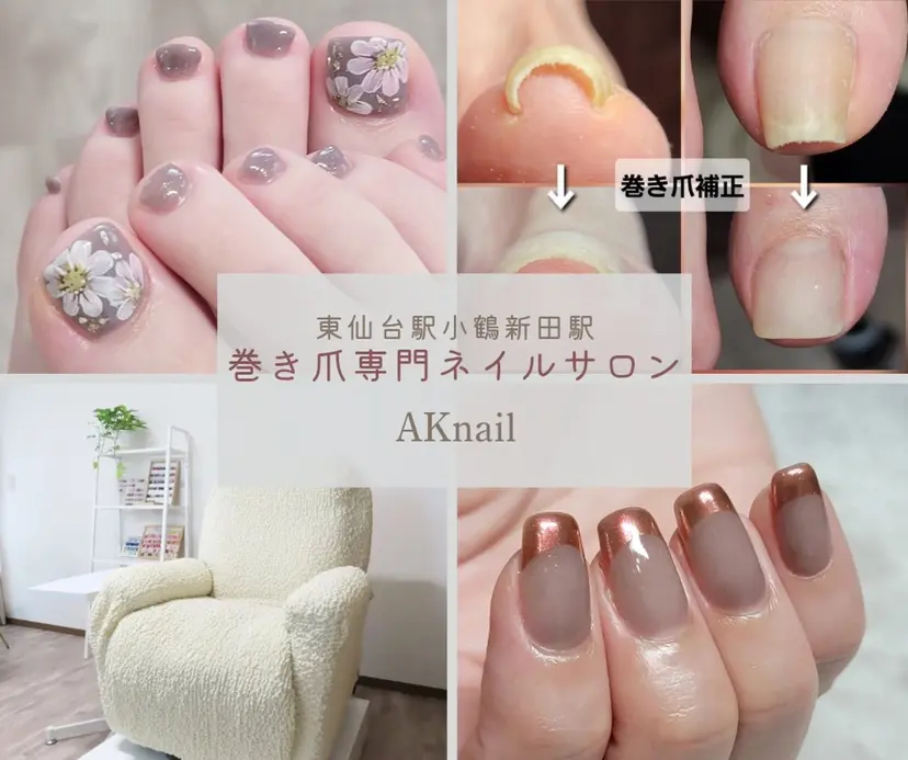 ネイル&巻き爪サロン 　AKnailの掲載