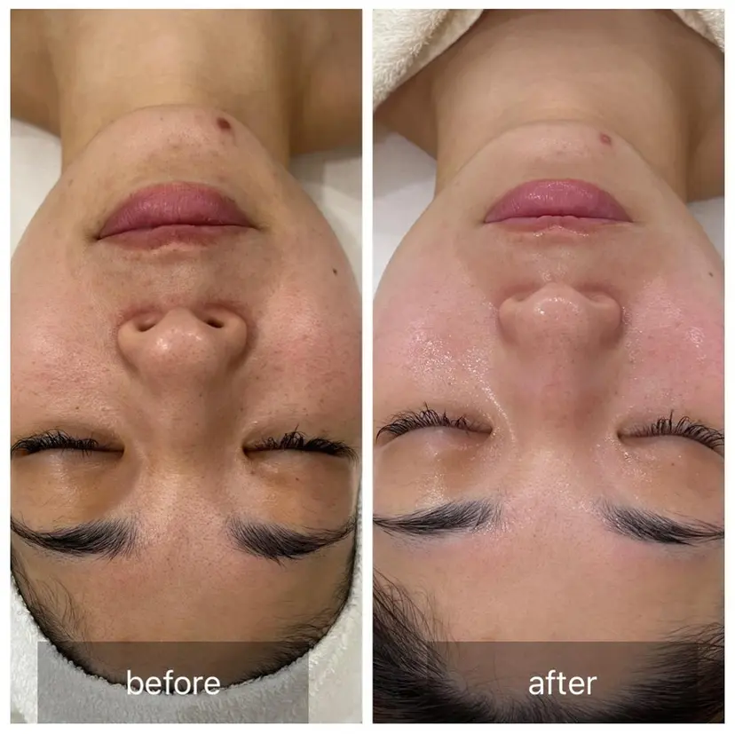 すっぴんたまご肌 平木さやかの掲載