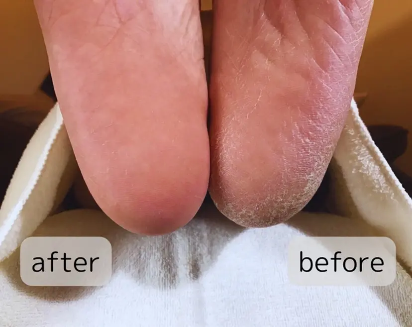 安城市美肌 イーズの掲載