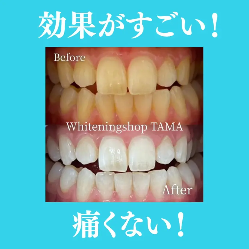 ホワイトニング ショップ多摩店の掲載