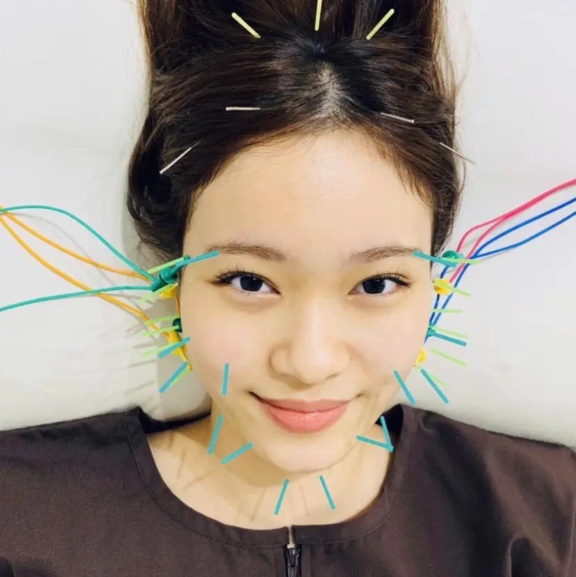 堀之内宏次 ［美容鍼灸師］の掲載