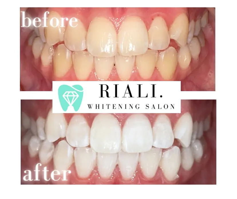 宮崎ホワイトニング サロンRIALI.の掲載