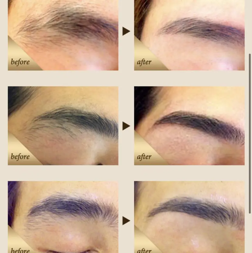 美容電気脱毛サロン HAENの掲載