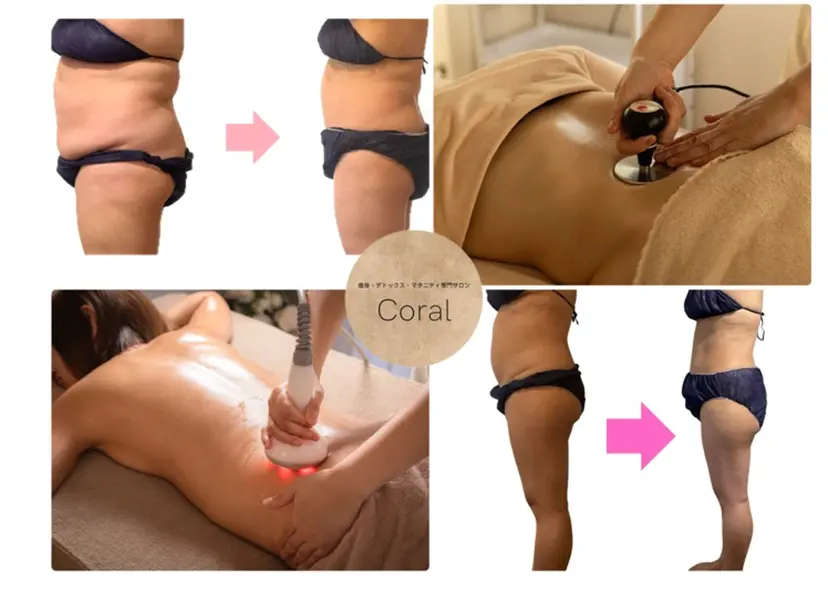 痩身専門サロン Coralの掲載