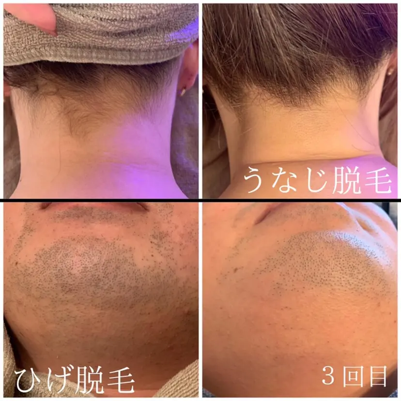 脱毛サロン Arumの掲載