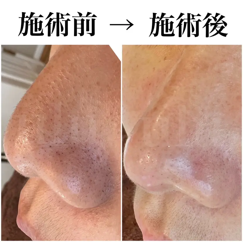 向井 まさよの掲載