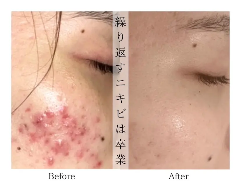 lelala 江坂店の掲載