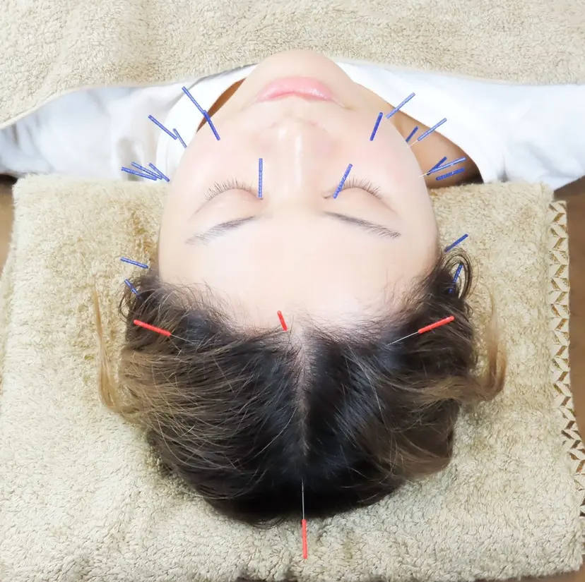 西葛西駅徒歩2分🚃 柔道整復師🪡鍼灸師の掲載