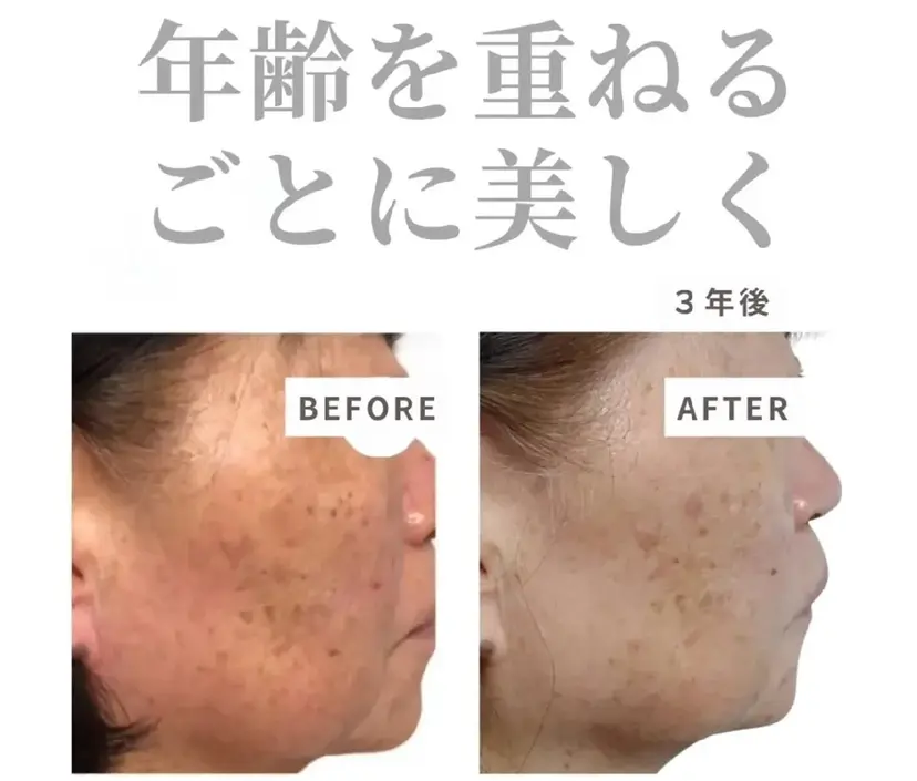 男女エステ ユニクリアの掲載