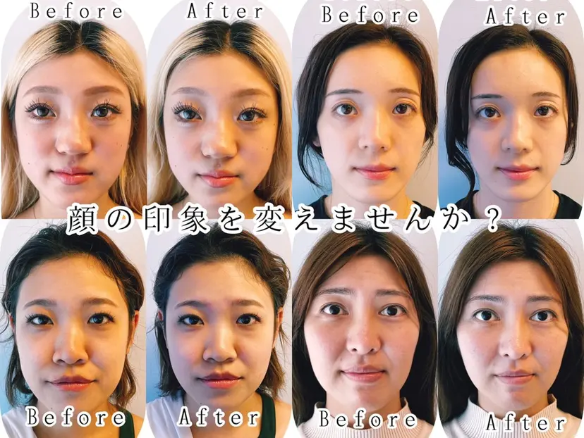 小顔美容鍼専門サロン 渋谷YZの掲載