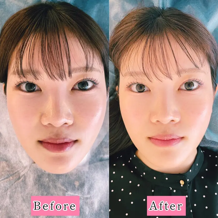 小顔美容鍼専門サロン 渋谷YZの掲載