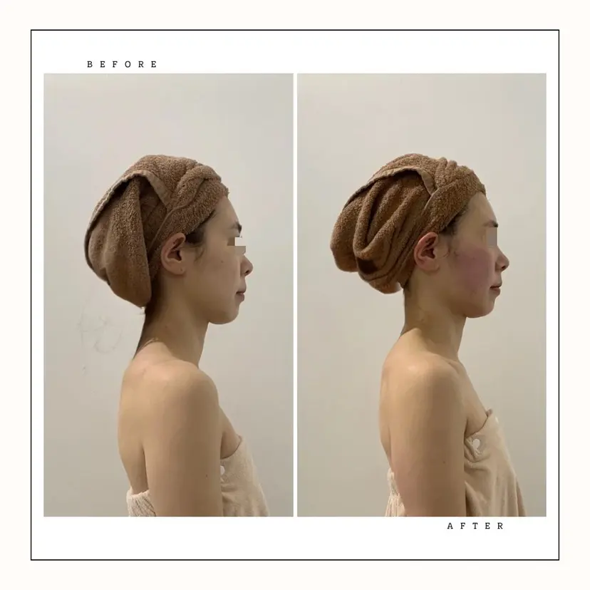 nam korugi 小顔整体コルギの掲載