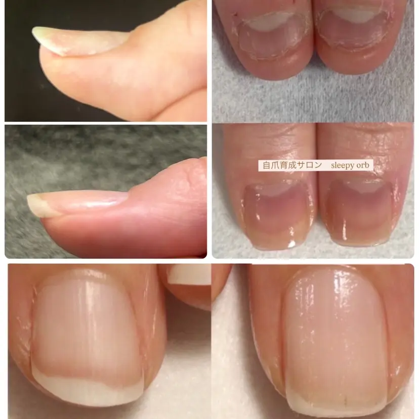 自爪育成眠れるサロン スリーピーオーブしずの掲載