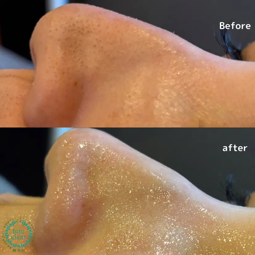 毛穴専門店 le e'rableの掲載