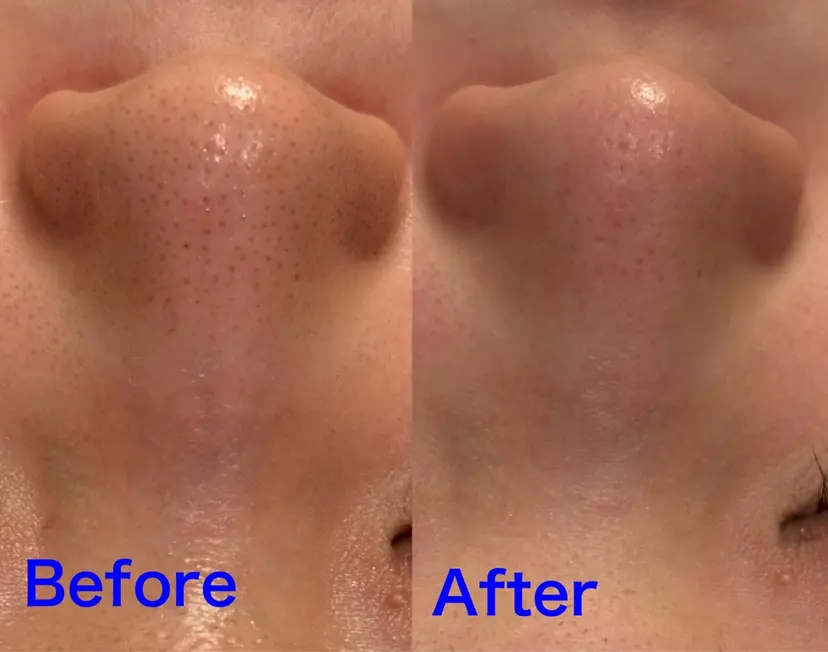 Fulala 永田の掲載