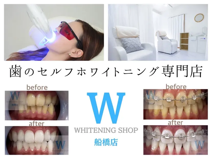 ホワイトニング ショップ船橋店の掲載