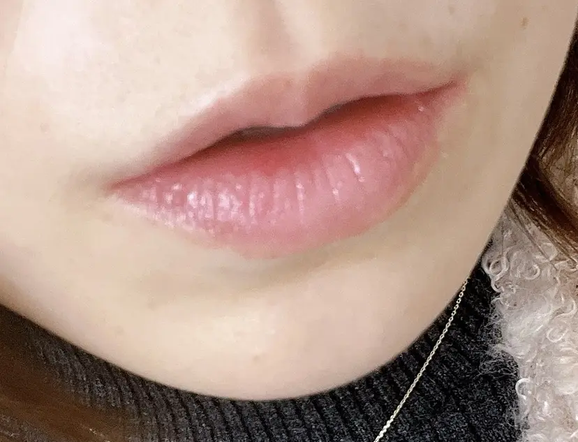 【ローマピンク施術】 Kaoの掲載