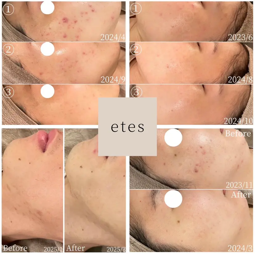 etes.tokyo 中目黒の掲載