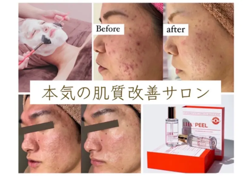 Horishia 博多店 Erikoの掲載