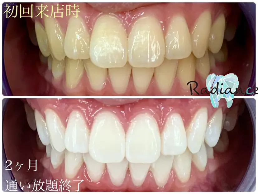 札幌ホワイトニング ラディアンス札幌駅店の掲載