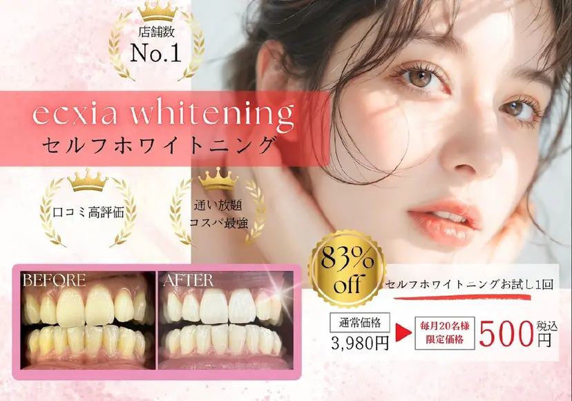 セルフホワイトニング エクシア大府店の掲載