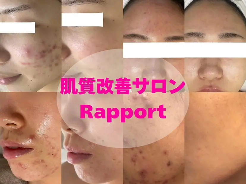 Rapport ラポールの掲載