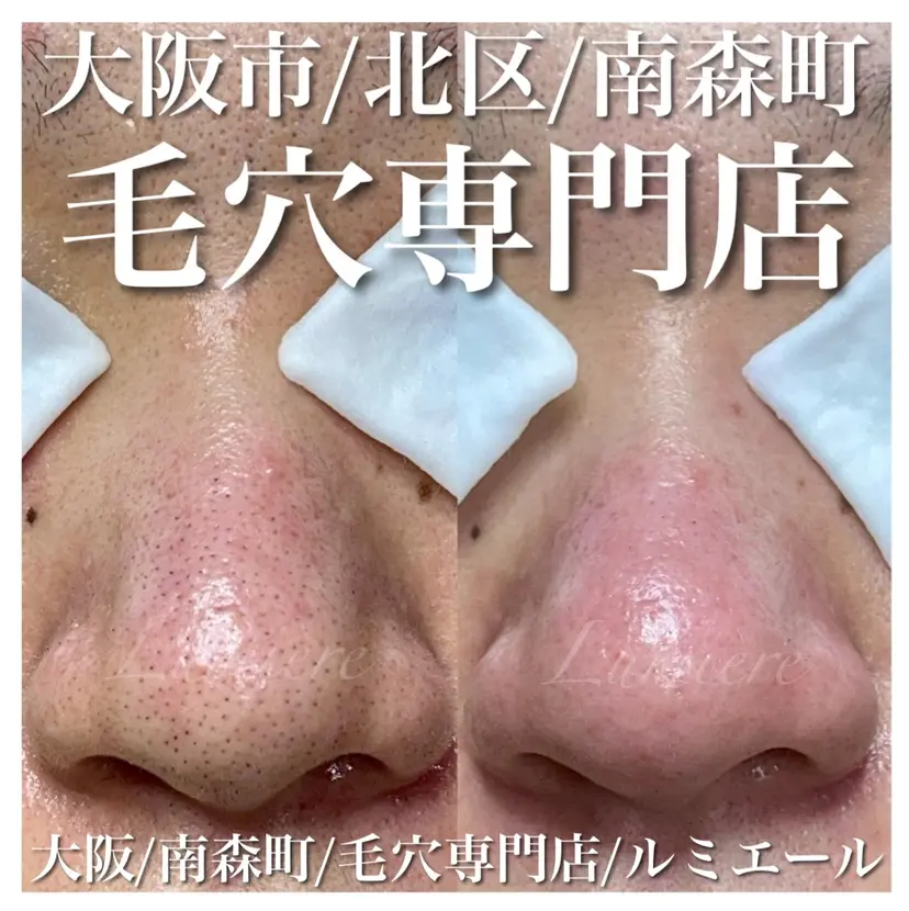 毛穴が綺麗になる 隠れ家サロン　南森町の掲載