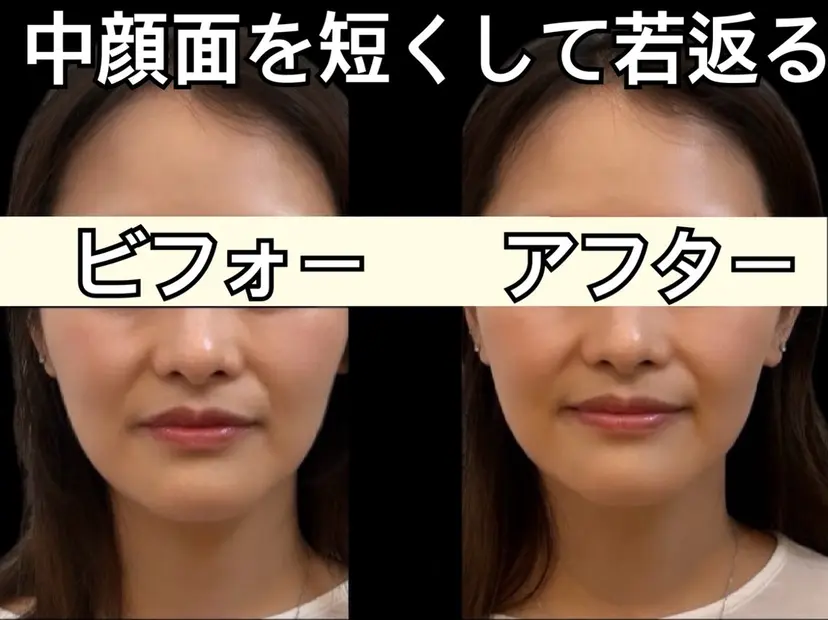 ローマピンクと小顔 クリニカルサロンココの掲載