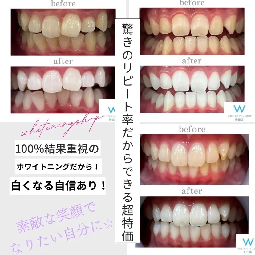 ホワイトニング ショップ町田店の掲載