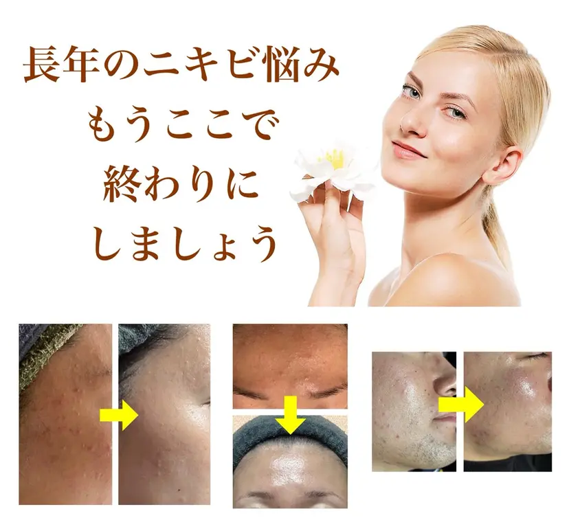 はが ゆかの掲載