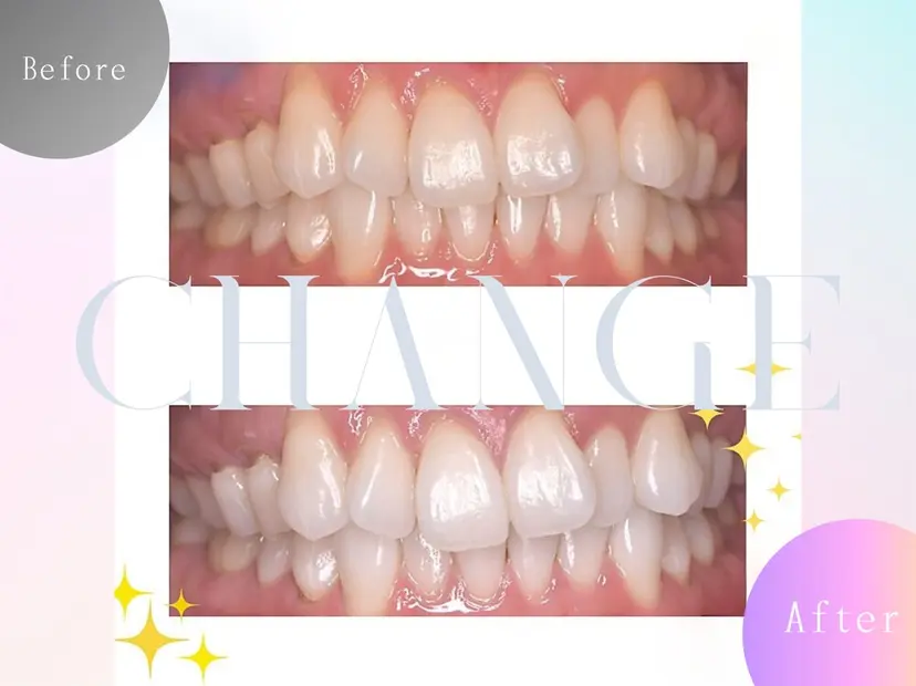 セルフホワイトニング エクシア福島の掲載