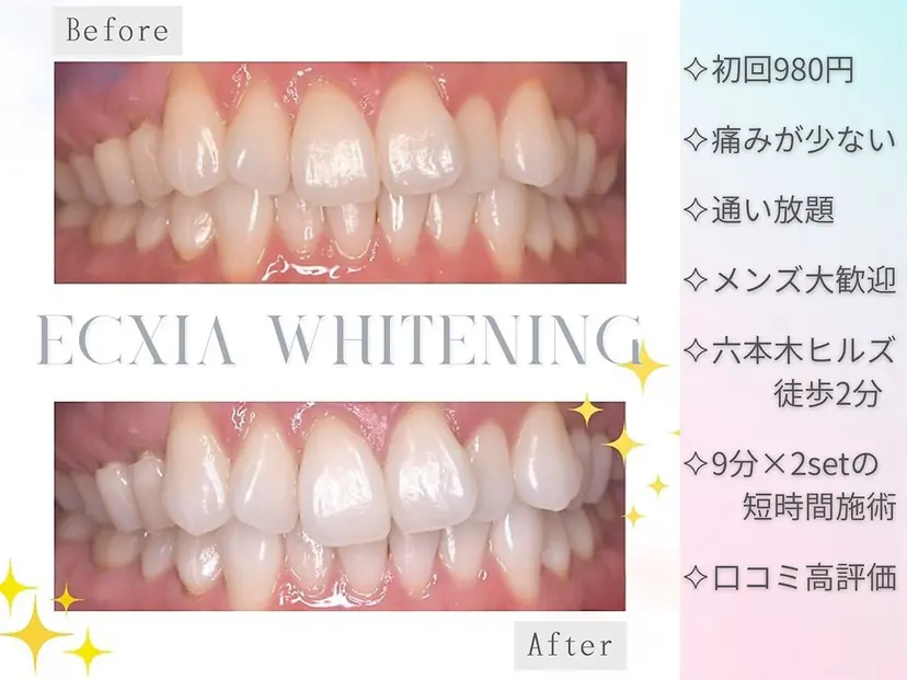 セルフホワイトニング エクシア六本木店の掲載