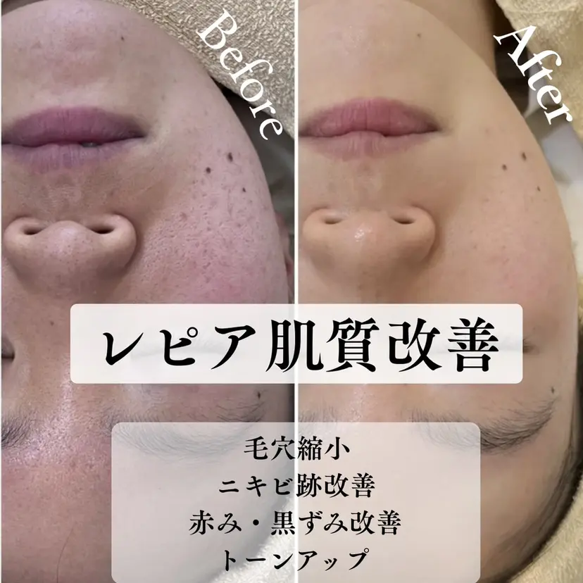 肌質管理専門店 Lé pia AMIの掲載