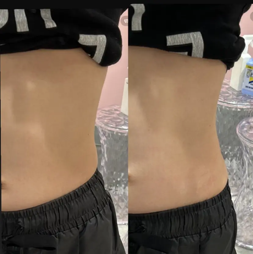 あたしnoエステ 静岡PARCO店の掲載