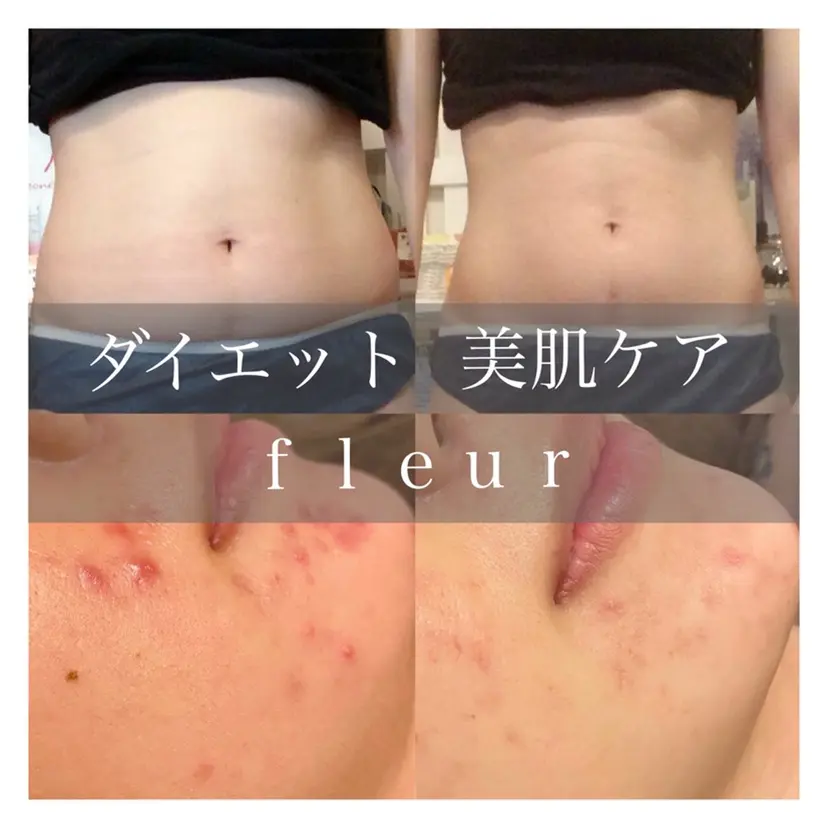 ダイエット・美肌ケア fleurの掲載