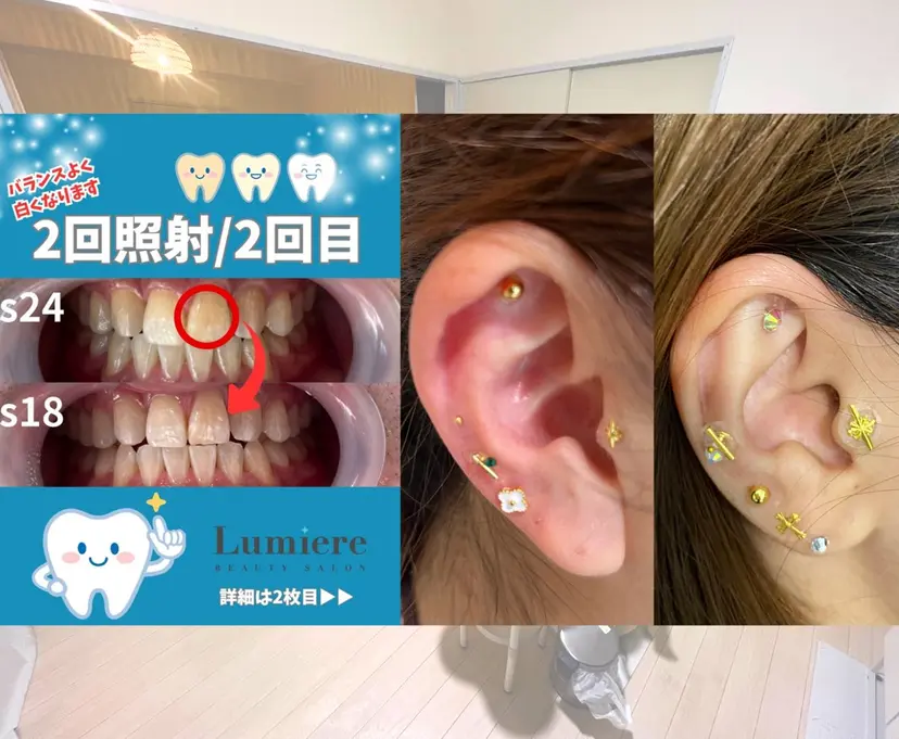 耳ツボジュエリー Lumiereの掲載
